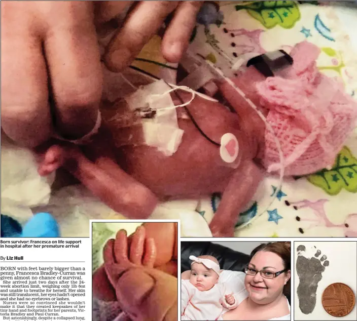  ??  ?? Born survivor: Francesca on life support in hospital after her premature arrival Precious: An adult holds Francesca’s hand