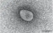  ?? NATIONAL INSTITUTE OF INFECTIOUS DISEASES / VIA KYODO ?? A sample of the COVID-19 omicron variant seen through an electronic microscope