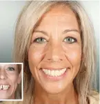  ?? Before and after pictures: EVODENTAL ??