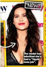  ??  ?? The model has admitted she’s had a “liquid nose job”.
