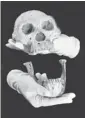  ??  ?? The 1.8 million-year-old pre-human skull and jaw captures early human evolution on the move.