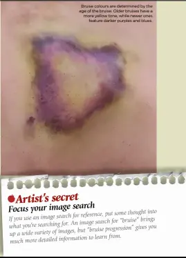  ??  ?? Bruise colours are determined by the age of the bruise. Older bruises have a more yellow tone, while newer ones feature darker purples and blues.