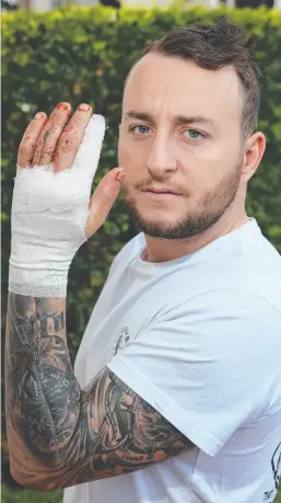  ?? Picture: GLENN HAMPSON ?? Southport resident Ryan Taylor suffered a paper cut which turned into necrotisin­g fasciitis, a flesh-eating disease.