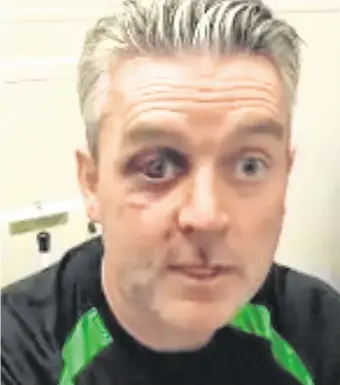  ??  ?? May now quit: Referee Daniel Sweeney posted a video message bemoaning feeling unsafe when he steps out to officiate a soccer match following the vicious attack he suffered