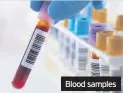  ??  ?? Blood samples