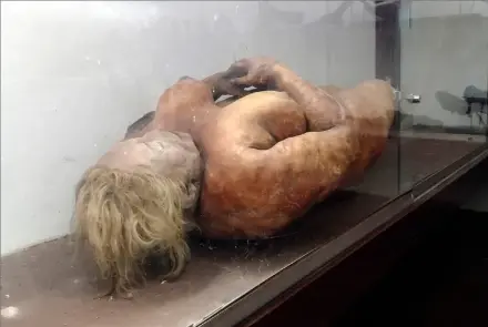  ??  ?? La momia está en el Museo de Anatomía de la Facultad de Medicina de Rosario