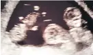  ??  ?? > The triplets are expected to be born next month