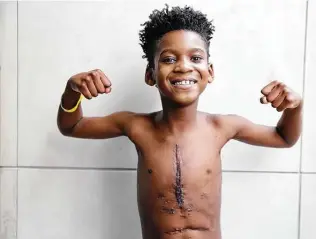  ?? Elizabeth Conley / Staff photograph­er ?? Nine-year-old Kingston Murriel displays the scars from his five heart surgeries Dec. 15 at Children’s Memorial Hermann Hospital in Houston. He was born with hypoplasti­c left heart syndrome.