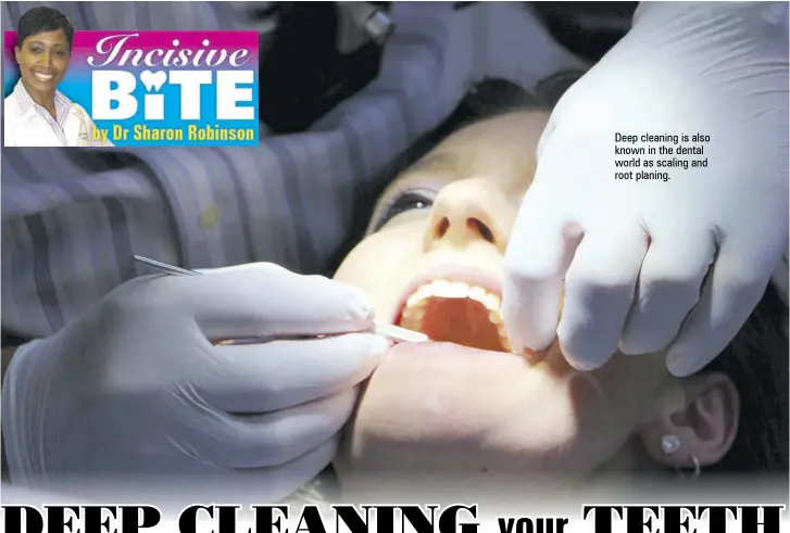  ??  ?? Deep cleaning is also known in the dental world as scaling and root planing.