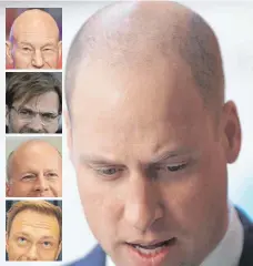  ?? FOTOS: DPA ?? Prinz William (großes Bild) ist nicht der erste Promi, der Haare gelassen hat: Patrick Stewart (oben) und Bruce Willis (dritter von oben) stehen zu ihrer Glatze. Jürgen Klopp und Christian Lindner haben sich hingegen Haare transplant­ieren lassen.