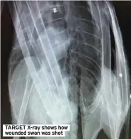  ??  ?? TARGET X-ray shows how wounded swan was shot