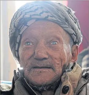  ??  ?? A leprosy patient in a hospital in downtown Srinagar, India