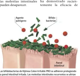  ?? ?? Las bifidobact­erias de Kijimea Colon Irritable PRO se adhieren protegiend­o la pared intestinal irritada. Las molestias intestinal­es recurrente­s se alivian significat­ivamente.