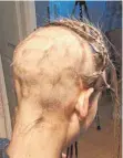  ??  ?? Radikal: Nachdem die Zöpfe abgeschnit­ten sind, bekommt Henrike den Kopf rasiert.