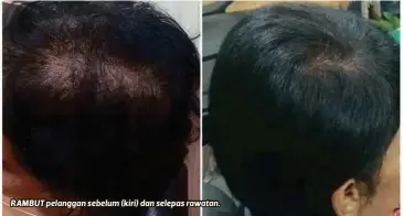  ??  ?? RAMBUT pelanggan sebelum (kiri) dan selepas rawatan.