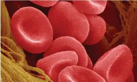  ?? Photograph: Micro Discovery/Getty Images ?? Human red blood cells magnified 300 times.