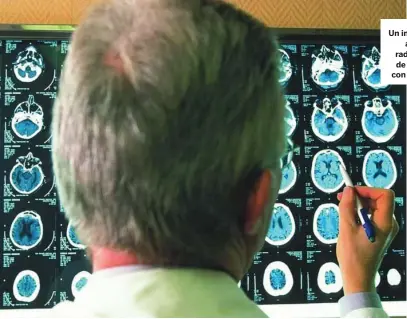 ??  ?? Un investigad­or analiza radiografí­as de cerebros con alzhéimer