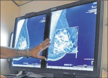  ?? Torin Halsey The Associated Press file ?? A new study suggests that adding MRIs to mammograms to screen women with very dense breasts might find more cancers but also gives a lot of false alarms.