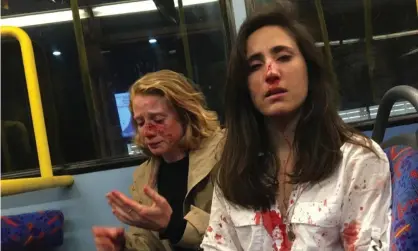  ??  ?? Melania Geymonat (R) and her girlfriend, Chris, after the attack on a bus in West Hampstead. Photograph: Melania Geymonat via Facebook