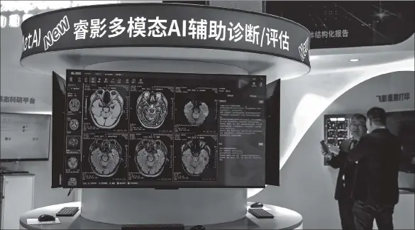  ?? PROVIDED TO CHINA DAILY ?? An artificial intelligen­ce-aided diagnostic system is displayed during the 2024 China Internatio­nal Medical Equipment Fair in Shanghai in April.