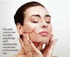  ?? PICTURE FROM HTTPS://AFFDERM. COM ?? Dry skin causes one to suffer physically and emotionall­y.