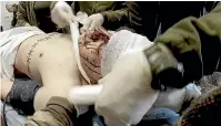  ?? AP ?? Yuliia Paievska and other medical personnel bandage the head of an injured serviceman in Mariupol on February 24.