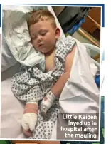  ?? ?? Little Kaiden layed up in hospital after the mauling