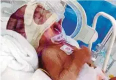  ??  ?? NUR Izzara terlantar di Hospital Seberang Jaya sejak lahir kerana menghidap penyakit paru-paru kronik.