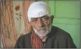  ??  ?? Mohammad Siduiq Kumar poses for photograph­s in his home after he was injured in a bear attack at Kangan, northeast of Srinagar, Kashmir. An elderly vegetable seller, Kumar was returning to his home with fodder for his cattle when attacked.