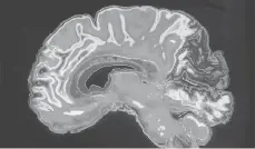  ??  ?? If true, the existence of optical communicat­ion channels could help unravel some of the vast unknowns about the brain.