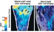  ?? Science ?? ANTIBODY THERAPY suppressed the simian version of HIV, known as SIV, by preserving crucial CD4+ T cells.