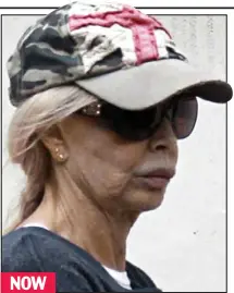  ??  ?? NOW
Make-up free: The 70-year-old’s face appears puffy