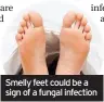  ??  ?? Smelly feet could be a sign of a fungal infection