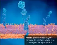  ??  ?? ARRIBA, proteína A-beta 42, responsabl­e del alzhéimer. Abajo, célula cancerígen­a del tejido epitelial.