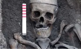  ??  ?? One of the skeletons’ hands showed signs of bare-knuckle fighting. Photograph: Wessex Archaeolog­y