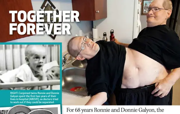  ??  ?? RIGHT: Conjoined twins Ronnie and Donnie Galyon spent the first two years of their lives in hospital (ABOVE), as doctors tried to work out if they could be separated.