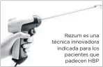  ??  ?? Rezum es una técnica innovadora indicada para los pacientes que padecen HBP