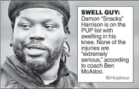  ?? Bill Kostroun ?? SWELL GUY: Damon “Snacks” Harrison is on the PUP list with swelling in his knee. None of the injuries are “extremely serious,” according to coach Ben McAdoo.