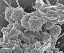  ?? NATIONAL INSTITUTE OF ALLERGY AND INFECTIOUS DISEASE ?? MRSA bacteria interact with human white blood cells.