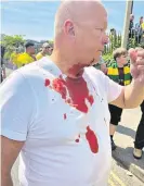  ?? ?? Blood-stained: A Leeds fan allegedly attacked outside Carrow Road