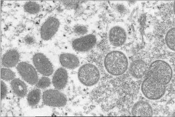 ?? THE CENTERS FOR DISEASE CONTROL AND PREVENTION ?? THIS 2003 ELECTRON MICROSCOPE IMAGE made available by the Centers for Disease Control and Prevention shows mature, oval-shaped monkeypox virions (left) and spherical immature virions (right) obtained from a sample of human skin associated with the 2003 prairie dog outbreak. Monkeypox, a disease that rarely appears outside Africa, has been identified by European and American health authoritie­s in recent days.