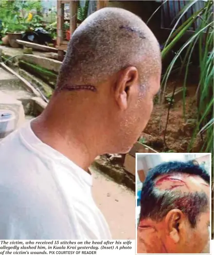  ?? PIX COURTESY OF READER ?? The victim, who received 15 stitches on the head after his wife allegedly slashed him, in Kuala Krai yesterday. (Inset) A photo of the victim’s wounds.