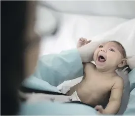  ?? FELIPE DANA / THE ASSOCIATED PRESS ?? The Zika virus has been linked to thousands of cases of microcepha­ly in Brazil, where women infected during pregnancy gave birth to infants with abnormally small heads.
