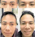  ?? ?? Eyebrows look artificial and too feminine (left); reconstruc­tion for natural brows for men (right)