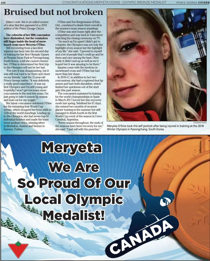  ?? FACEBOOK PHOTO ?? Meryeta O’Dine took this self portrait after being injured in training at the 2018 Winter Olympics in Pyeongchan­g, South Korea.