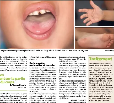 La Saison Du Pied Mainbouche Commence Soins Traitement Pressreader
