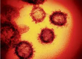  ?? NIAID-RML TNS ?? An image from an electron microscope shows SARS-CoV-2, the virus that causes COVID-19.