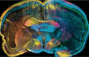  ?? (LUIS DE LA TORRE-UBIETA, GESCHWIND LABORATORY, UCLA) ?? Cerveau de souris coupé verticalem­ent pour séparer sa partie avant de sa partie arrière.