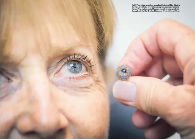  ?? Photos/ Michael Craig ?? Keith Pine colour matches a replica iris that will be fitted to the new prosthetic eye he is making for Auckland patient Karen; Pine makes up to 15 eyes a month in pop- up clinics throughout the North Island ( below).
