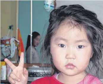  ?? FOTO: MONGOLIA HELP ?? Munkhzayaa 2011 vor ihrer ersten Operation: Nun muss das mongolisch­e Mädchen erneut am Kopf operiert werden, weil der Tumor wieder nachgewach­sen ist.